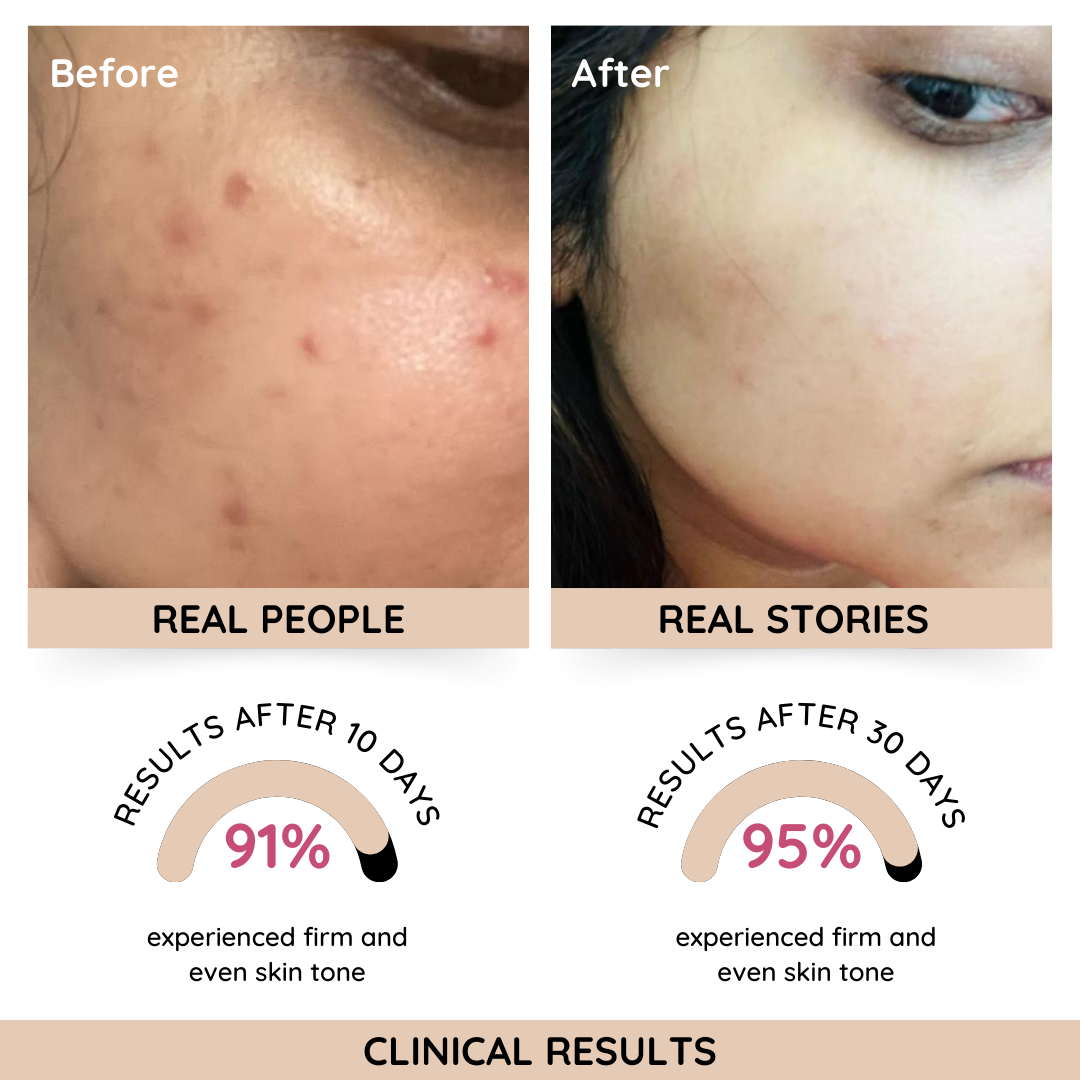 Suroskie Rose Glass - Hydration Moisturizer with Copper Peptides & Ceramides - Hydration, Barrier Repair, Lightweight, Suitable for All Skin Type (50ml)