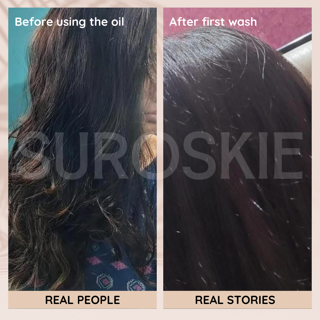 Champi Hair Massage Oil  For Scalp & Hair Growth - Rituals - Hair Oil
