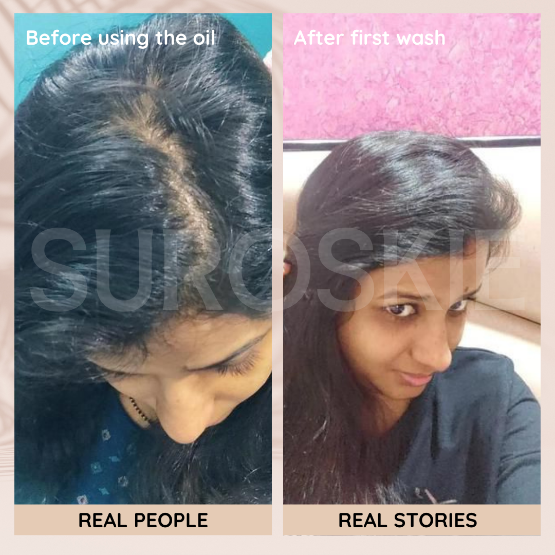 Champi Hair Massage Oil  For Scalp & Hair Growth - Rituals - Hair Oil