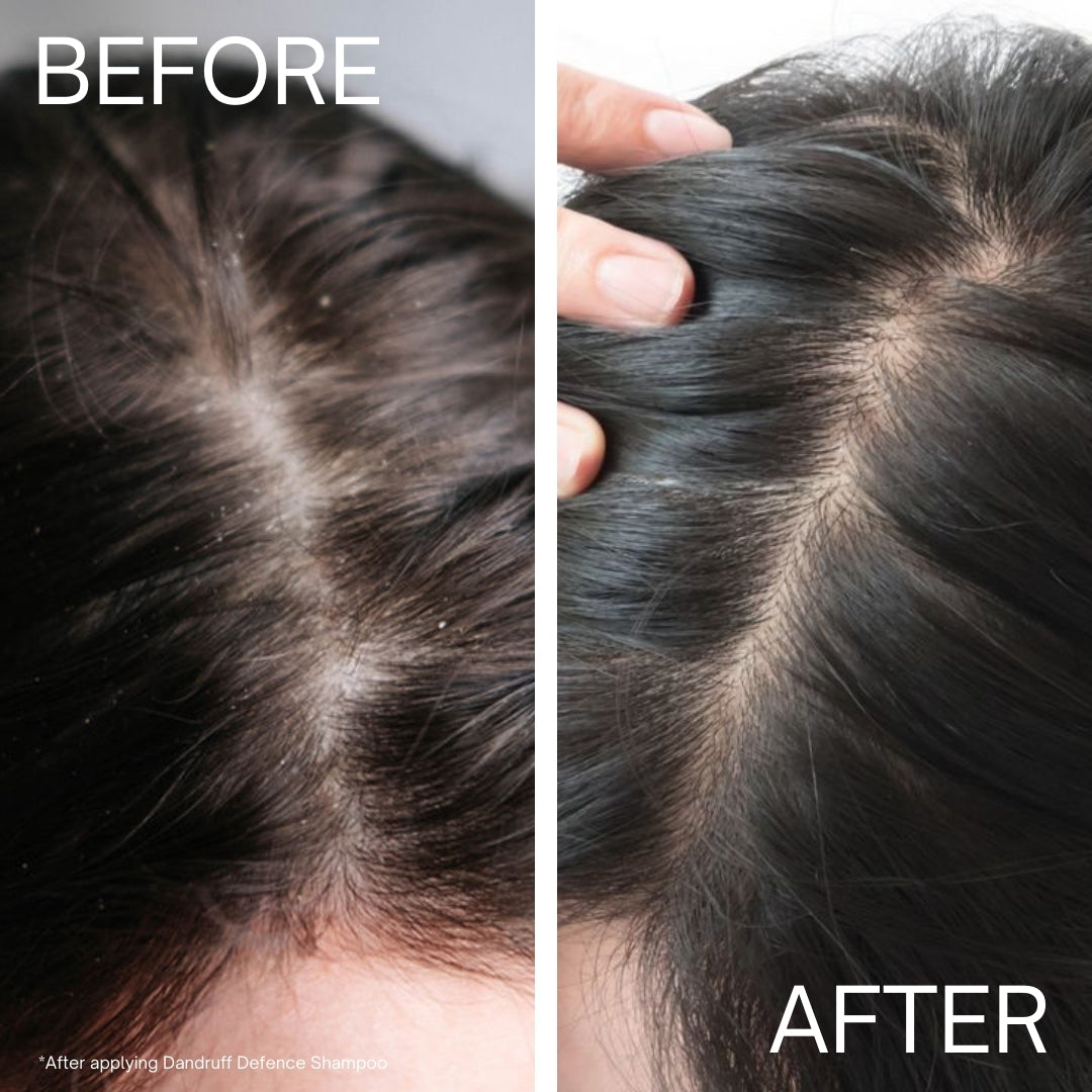 Dandruff Defence Shampoo