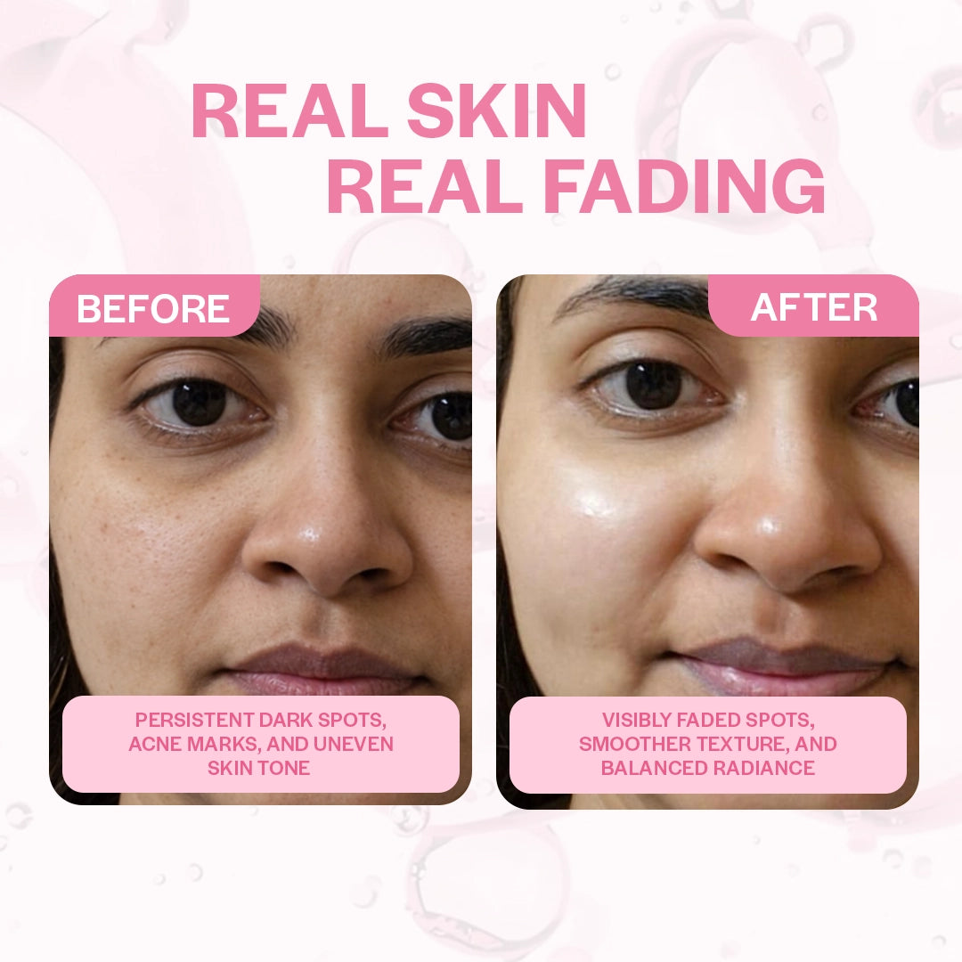 Pack Off 3 SPOTLESS TXA PEEL OFF MASK