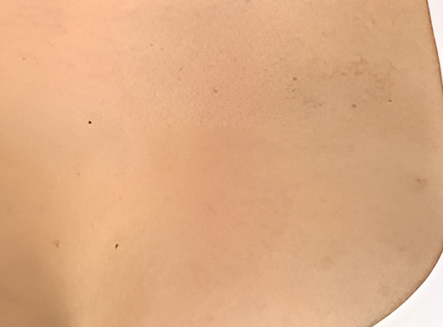After image