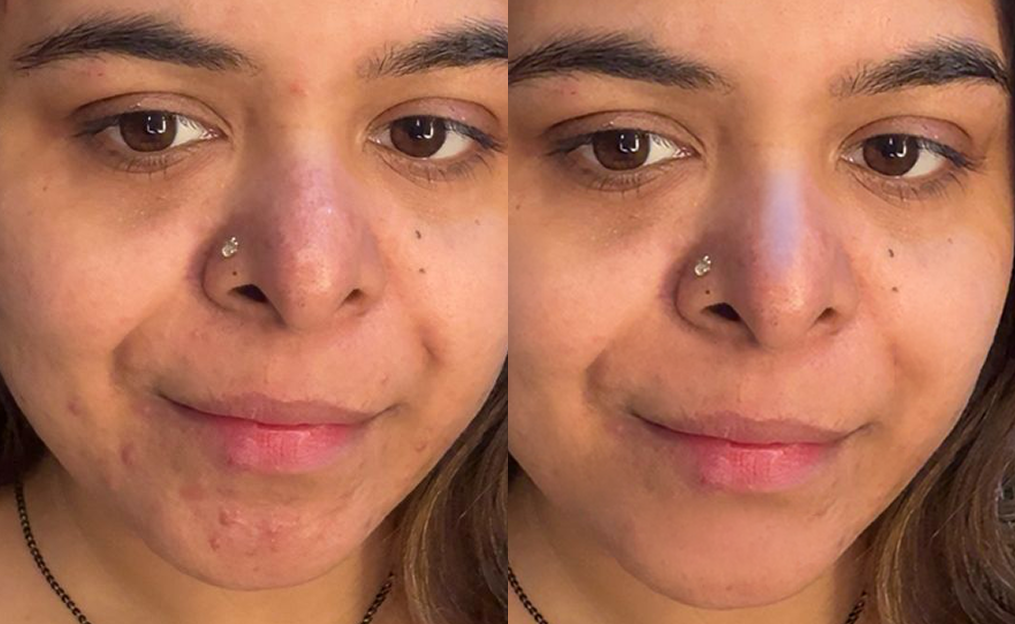 DARK SPOTS
