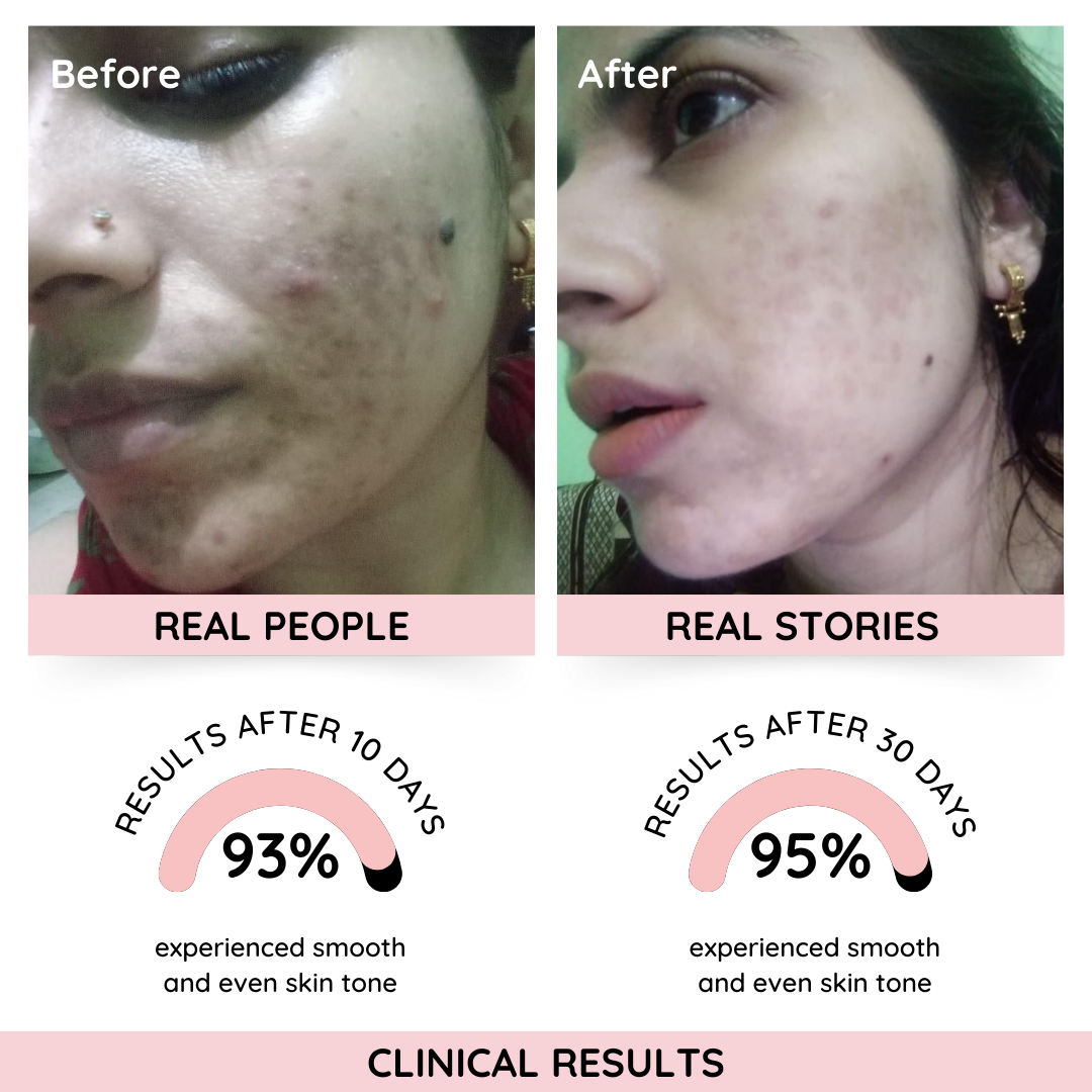 ( SUPER STORE ) Rose Instant Glow Enzyme Scrub