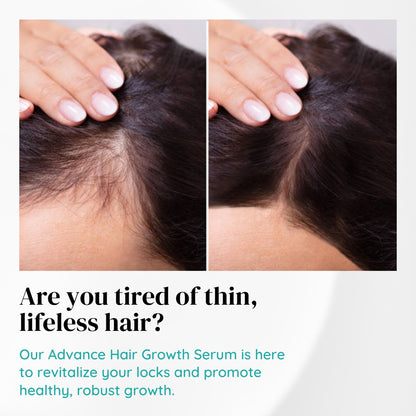 Advance Hair Growth Serum