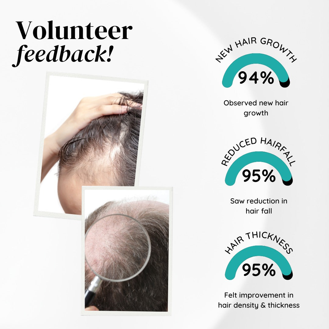 Advance Hair Growth Serum