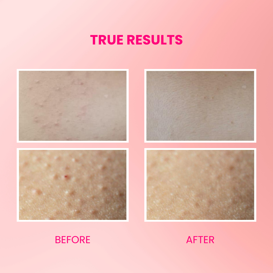 Suroskie Velvet Glaze Exfoliating Glow 2-in-1 Body Scrub Wash - Results